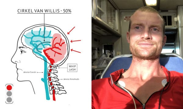 Last van wazig zien? Druk op je hoofd? Haarwortelpijn? Goeie kans dat